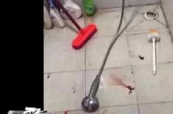 女子上厕所蹲坑突爆裂 割断脚筋大出血