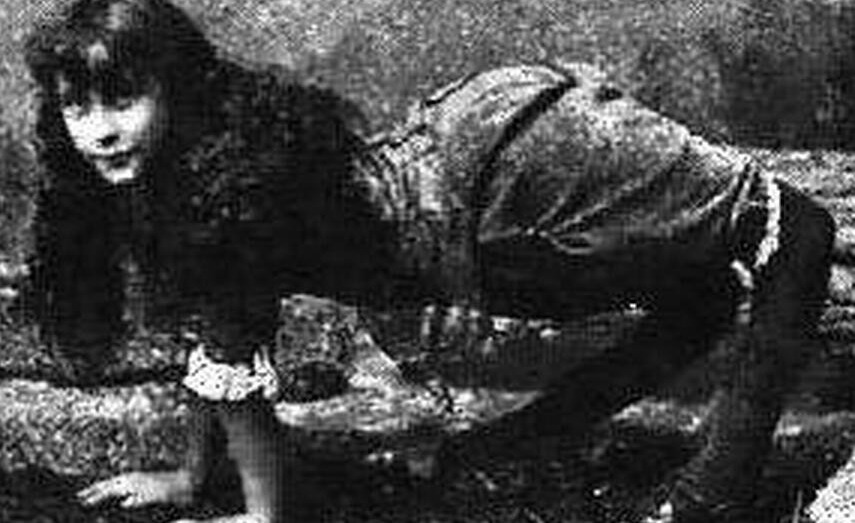 人类历史上九大怪胎四腿女人和独角兽
