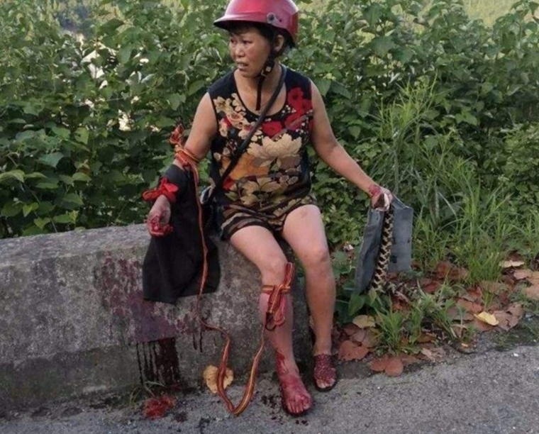 农妇遭五步蛇空袭