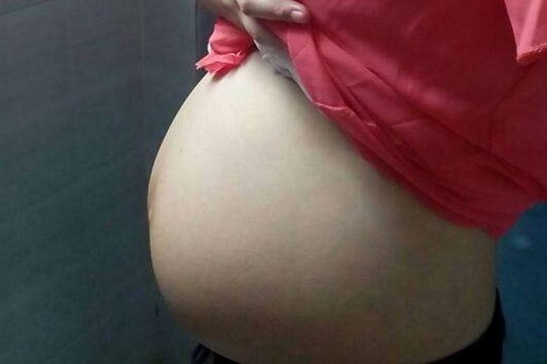 10岁女童怀孕8个月