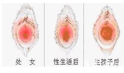 女人下面的真实模样