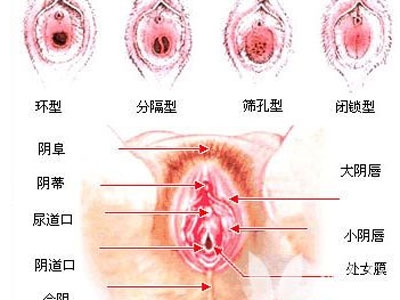 女人下面的真实模样