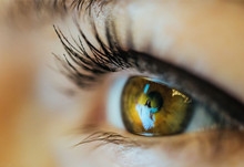 眼睛有红血丝是什么原因 去除眼睛红血丝的办法