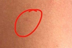 北京红黄蓝幼儿园被曝涉嫌虐童 多名幼儿身上现