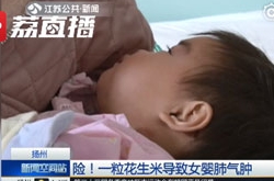 13个月的小孩被亲戚喂花生米呛进气管