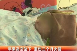 广东女婴被苹果砸中生命垂危 警方提取住户DNA调
