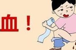 内痔出血用什么药最好？专家教你止血用妙招